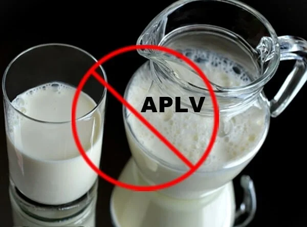 APLV Alergia à proteína do leite de vaca